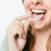 INVISIBLE ALIGNERS
